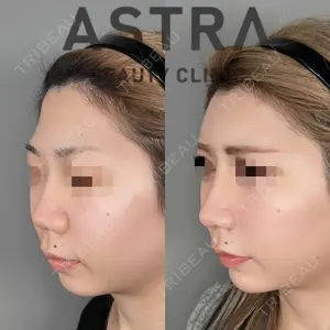 ASTRA BEAUTY CLINIC 塩満 惠子医師の症例