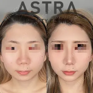 ASTRA BEAUTY CLINIC 塩満 惠子医師の症例