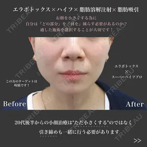 共立美容外科 京都院の症例