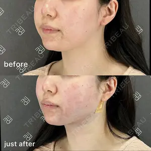 EMMO FACE CLINIC 大阪梅田院 山﨑 冴羅医師の症例