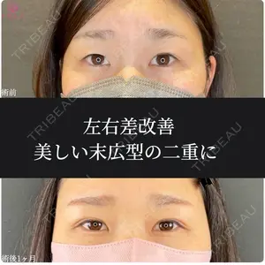 ルラ美容クリニック 福岡院の症例