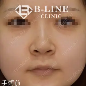 B-LINE CLINIC 池袋院 小池 康弘医師の症例