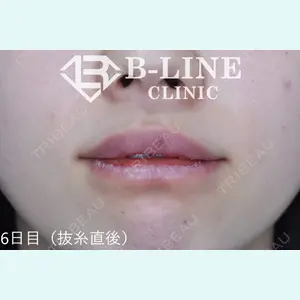 B-LINE CLINIC 池袋院 小池 康弘医師の症例