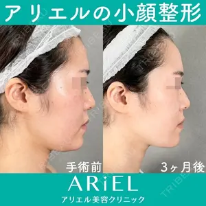 アリエル美容クリニック 大宮院 鈴木　桂介医師の症例