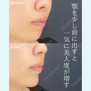 HAAB×DREAM BEAUTY CLINIC 東京本院 吉村 衣里子医師の症例