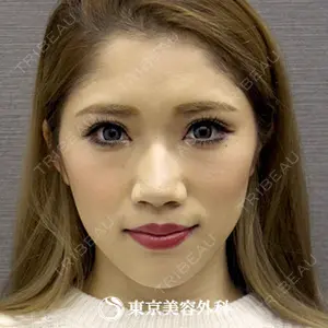 東京美容外科 青森院の症例