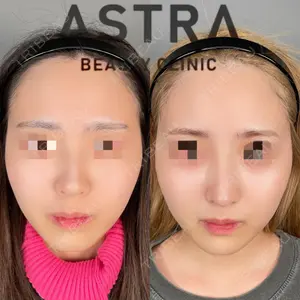 ASTRA BEAUTY CLINIC 塩満 惠子医師の症例