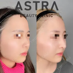 ASTRA BEAUTY CLINIC 塩満 惠子医師の症例