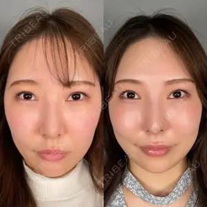 ASTRA BEAUTY CLINIC 塩満 惠子医師の症例