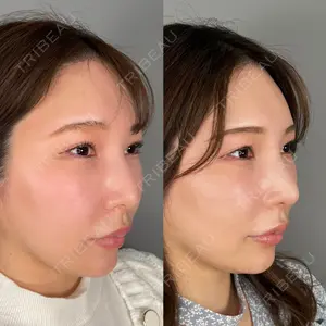 ASTRA BEAUTY CLINIC 塩満 惠子医師の症例