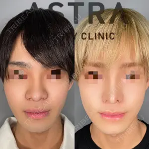 ASTRA BEAUTY CLINIC 塩満 惠子医師の症例