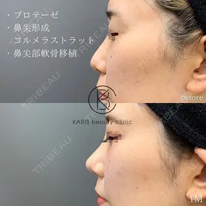 KARIS beauty clinic 滝内 ヒロフミ医師の症例