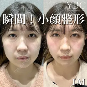 YBC横浜美容外科 大宮院の症例