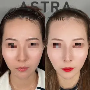 ASTRA BEAUTY CLINIC 塩満 惠子医師の症例