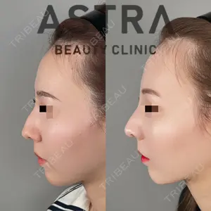 ASTRA BEAUTY CLINIC 塩満 惠子医師の症例