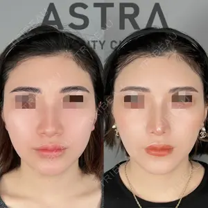 ASTRA BEAUTY CLINIC 塩満 惠子医師の症例