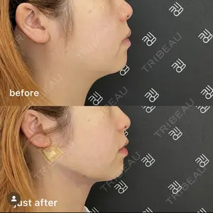 EMMO FACE CLINIC 大阪梅田院 山﨑 冴羅医師の症例