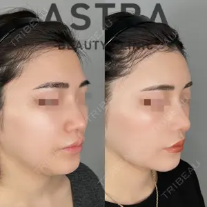 ASTRA BEAUTY CLINIC 塩満 惠子医師の症例