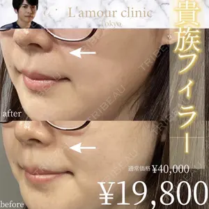 L‘amour clinic Tokyo【ラムールクリニック東京】 片岡 紘士医師の症例