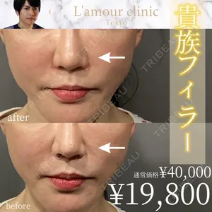 L‘amour clinic Tokyo【ラムールクリニック東京】 片岡 紘士医師の症例