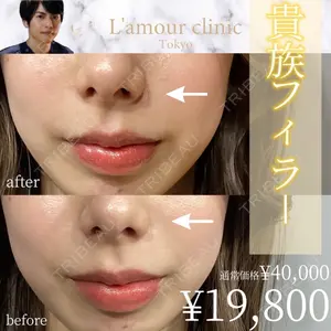 L‘amour clinic Tokyo【ラムールクリニック東京】 片岡 紘士医師の症例