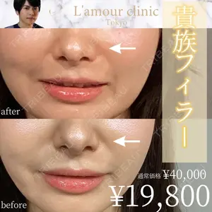 L‘amour clinic Tokyo【ラムールクリニック東京】の症例