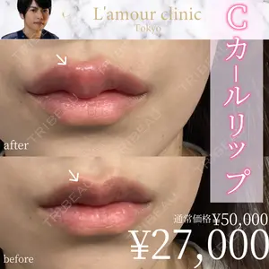 L‘amour clinic Tokyo【ラムールクリニック東京】 片岡 紘士医師の症例