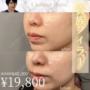 L‘amour clinic Tokyo【ラムールクリニック東京】の症例