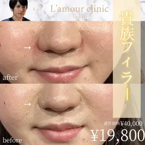 L‘amour clinic Tokyo【ラムールクリニック東京】 片岡 紘士医師の症例