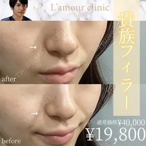 L‘amour clinic Tokyo【ラムールクリニック東京】 片岡 紘士医師の症例