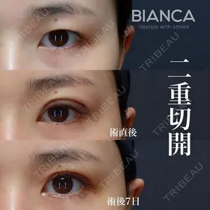 BIANCA銀座 雜賀 俊行医師の症例