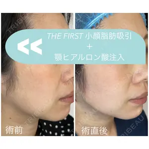 THE FIRST CLINIC 多摩センター院 惟村 公郁医師の症例