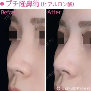 東京形成美容外科 船橋院 山崎 修吾医師の症例