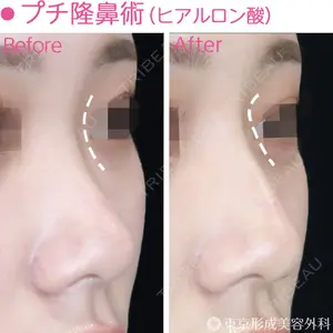 東京形成美容外科 船橋院 山崎 修吾医師の症例
