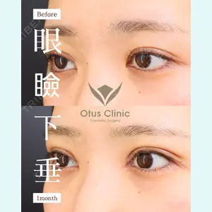 Otus Clinic 【オータスクリニック】 中 徳太郎医師の症例