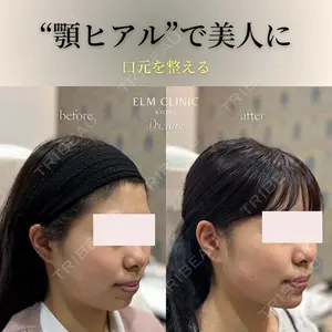 美容皮膚科エルムクリニック 広島院の症例