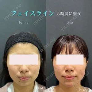 美容皮膚科エルムクリニック 京都院の症例