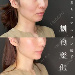 美容皮膚科エルムクリニック 神戸院 七里 阿寿美医師の症例