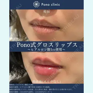 Pono clinic 【ポノクリ】の症例