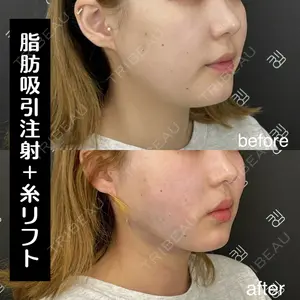 EMMO FACE CLINIC 大阪梅田院 山﨑 冴羅医師の症例