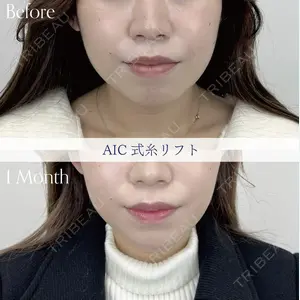 AI Beauty Clinic （エーアイ美容クリニック） 尾崎 宥文医師の症例