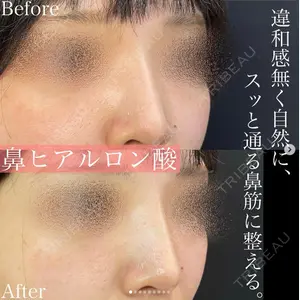 症例