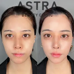 ASTRA BEAUTY CLINIC 塩満 惠子医師の症例