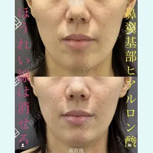 EMMO FACE CLINIC 大宮院 廣松 直樹医師の症例