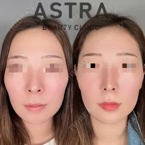 ASTRA BEAUTY CLINIC 塩満 惠子医師の症例