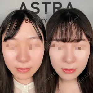 ASTRA BEAUTY CLINIC 塩満 惠子医師の症例