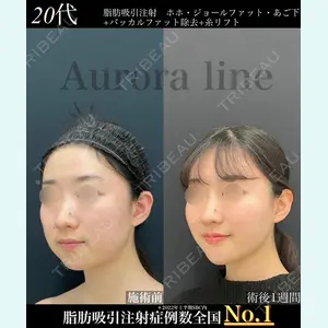湘南美容クリニック 松戸院の症例