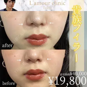 L‘amour clinic Tokyo【ラムールクリニック東京】 片岡 紘士医師の症例