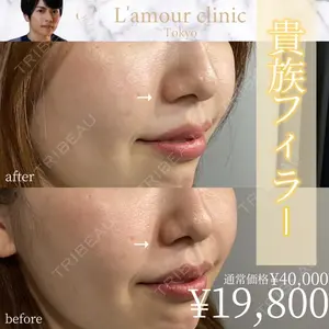 L‘amour clinic Tokyo【ラムールクリニック東京】 片岡 紘士医師の症例