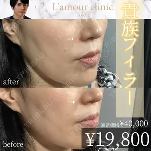 L‘amour clinic Tokyo【ラムールクリニック東京】 片岡 紘士医師の症例